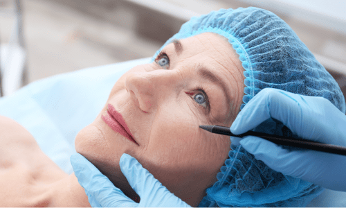 Cirugía de blefaroplastia